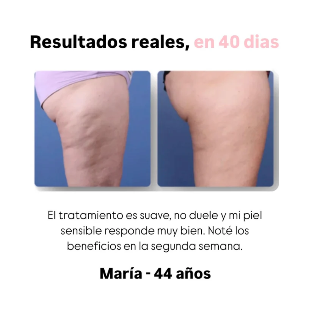 ThermaSculpt Pro – Tu aliado en salud, belleza y bienestar
